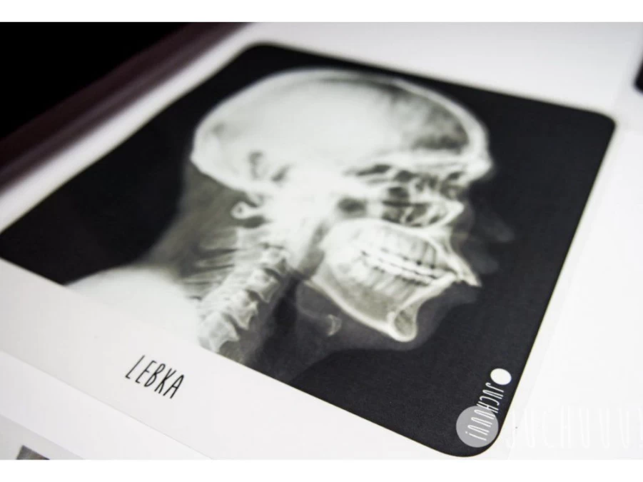 Utukutu Translucent Set X-Ray Of The Human Body | Light Panel And Accessories