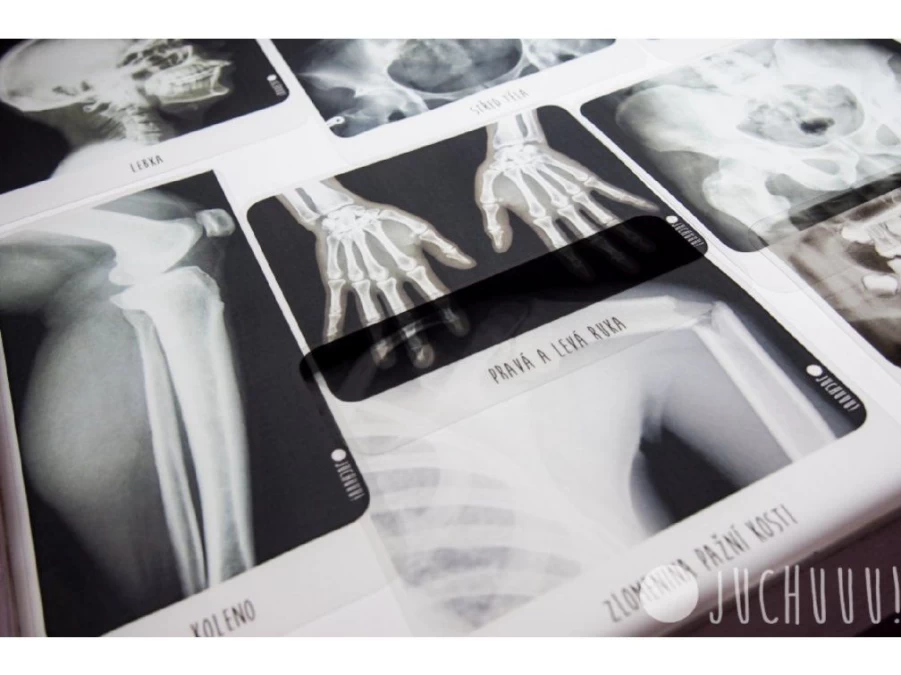 Utukutu Translucent Set X-Ray Of The Human Body | Light Panel And Accessories